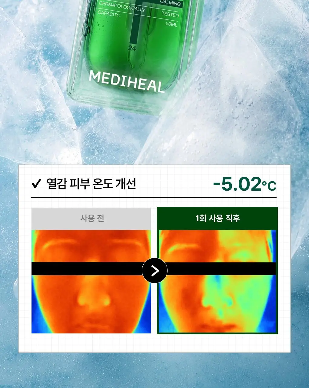 [업그레이드 수분진정세럼] 메디힐 티트리 더마 세럼 50mL 상세페이지 14